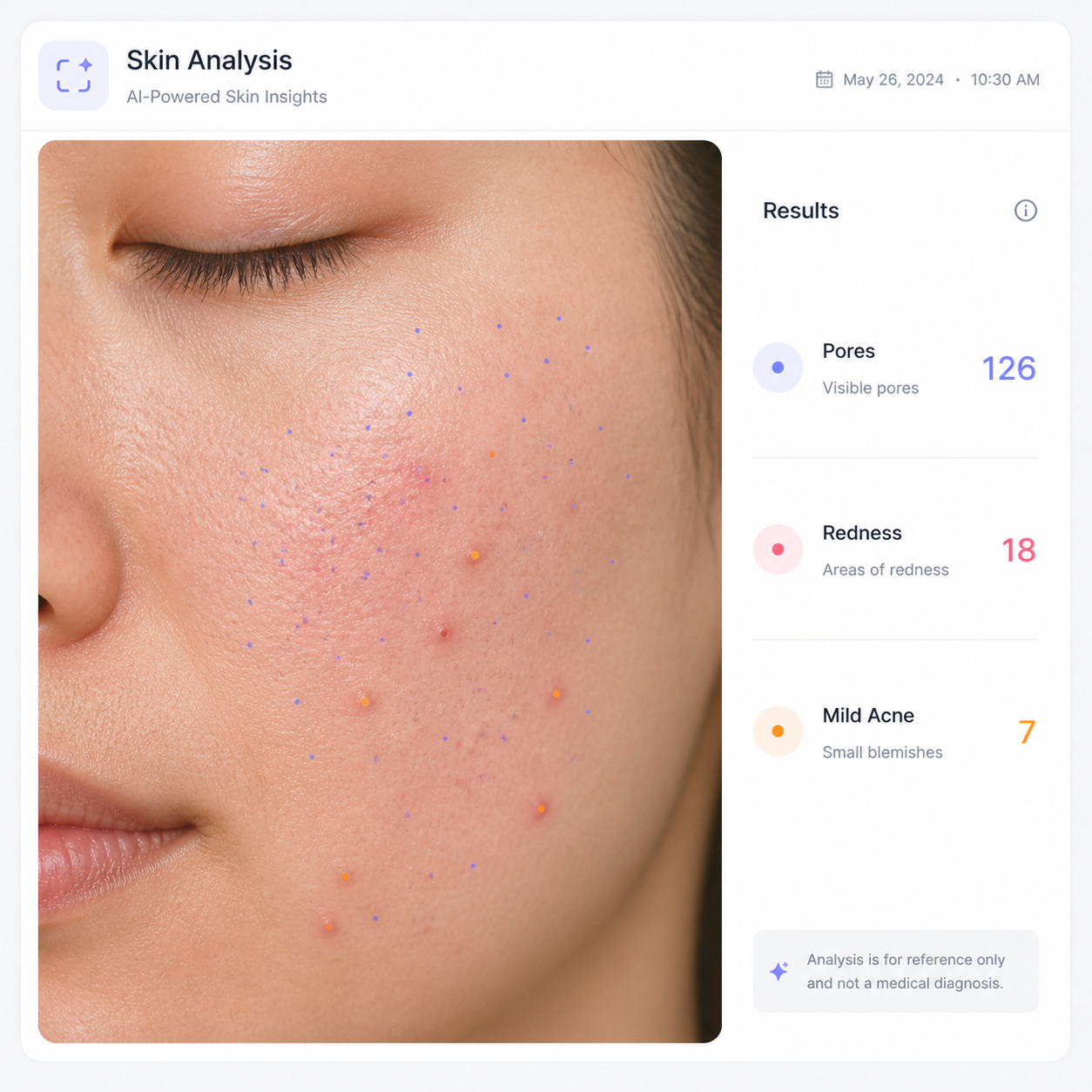 SkinMax örneği